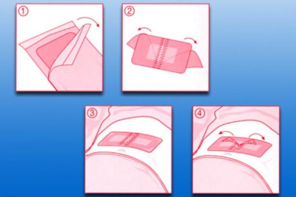 Inselpflaster Rudafilm steril, 50 Stück
